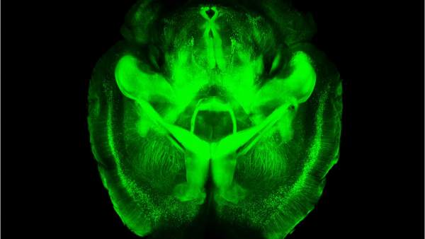 Cerebro transparente Cerebro transparente