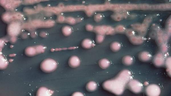 Klebsiella pneumoniae Klebsiella pneumoniae