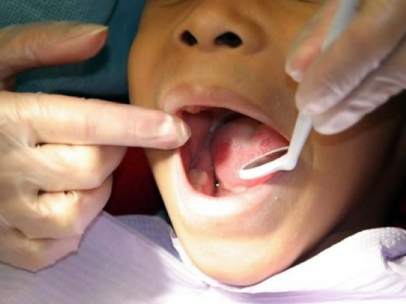 Visita al dentista