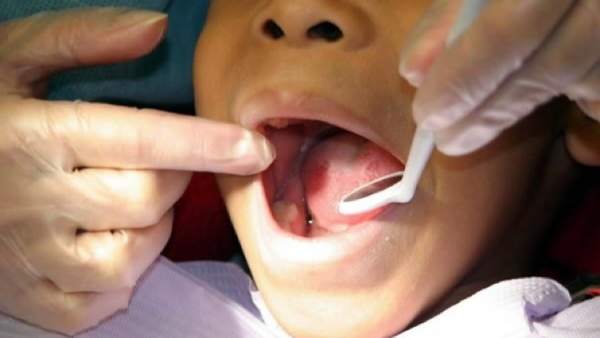 Visita al dentista Visita al dentista