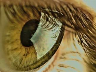 Retina