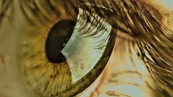 Retina Retina