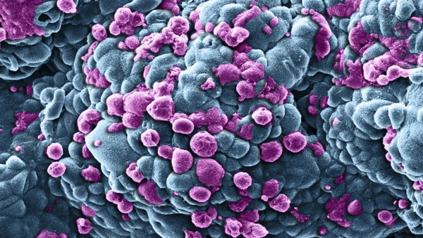 Breast cancer cells treated with nano sized drug carriers Breast cancer cells treated with nano sized drug carriers