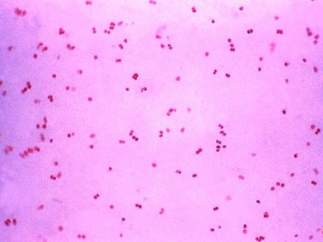 Gonorrea