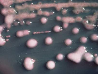 Bacteria