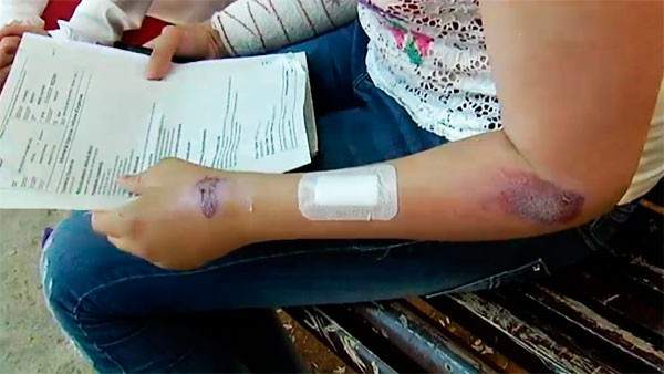 Agresión a un transexual en Valencia Agresión a un transexual en Valencia