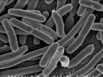 Bacteria en el intestino humano