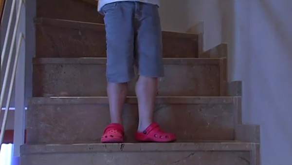 Enfermedad de Duchenne Enfermedad de Duchenne
