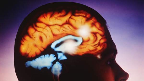Cerebro Cerebro