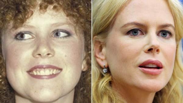 Nicole Kidman Nicole Kidman