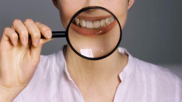 Dientes Dientes