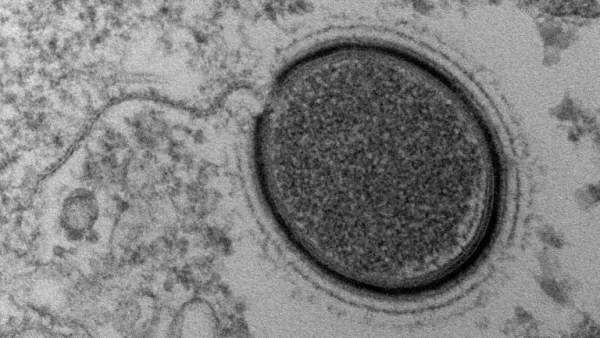 Virus Mollivirus Virus Mollivirus