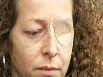 Esther Quintana, la mujer que perdiò un ojo por una pelota de goma