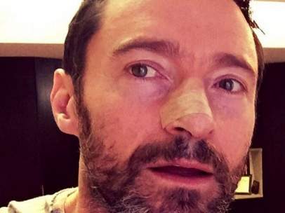 Hugh Jackman