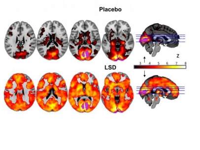 Efectos del LSD en el cerebro