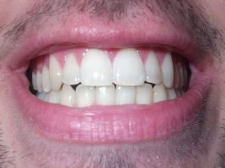 Dentadura humana