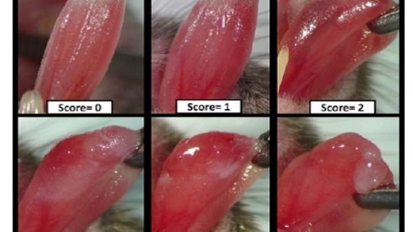 Escala para estimar la mucositis oral inducida por radioterapia Escala para estimar la mucositis oral inducida por radioterapia
