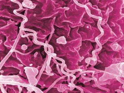 Treponema pallidum, bacteria de la sífilis