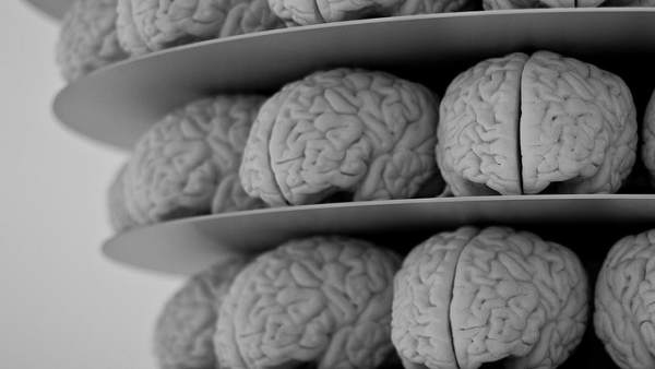 Cerebro, Alzheimer. Cerebro, Alzheimer.