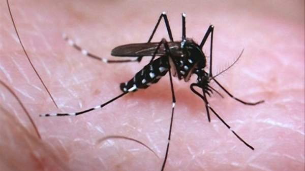 Primer caso de microcefalia por zika en España Primer caso de microcefalia por zika en España