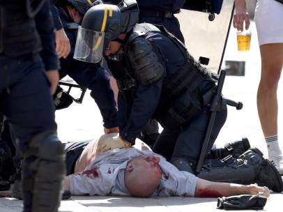 'Hooligan' herido en Marsella