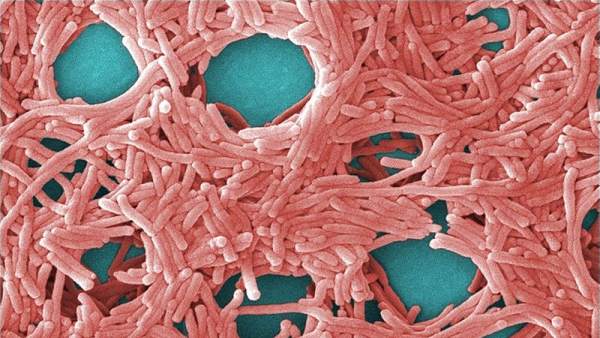 Legionella Legionella