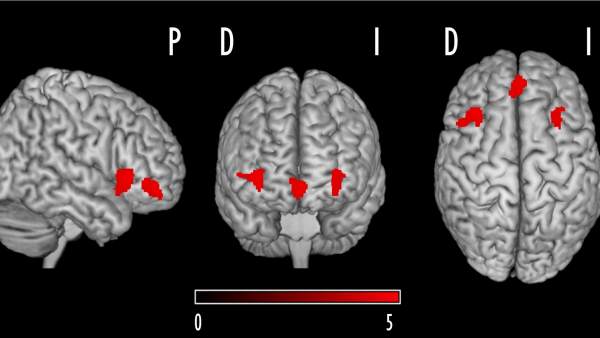 Imagen de cerebro Imagen de cerebro