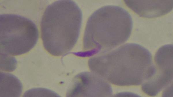 Parásito del Chagas Parásito del Chagas