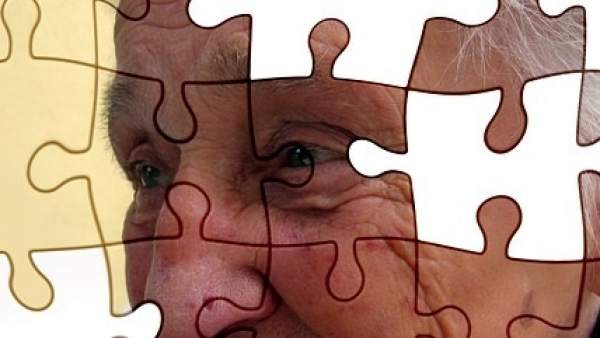 Alzheimer Alzheimer