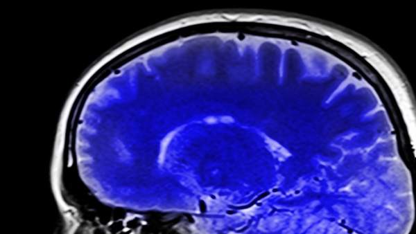 Cerebro Cerebro