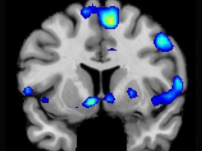 Imagen del estudio publicado en la revista especializada Social Neuroscience.