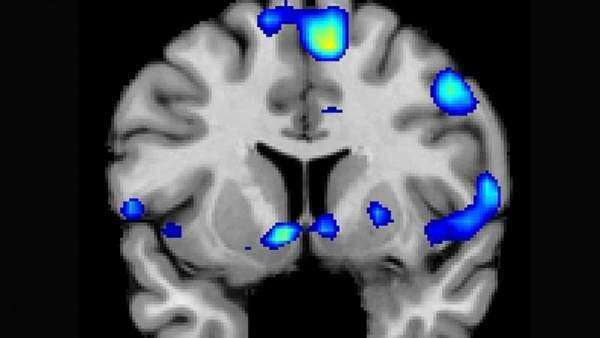 Imagen del estudio publicado en la revista especializada Social Neuroscience. Imagen del estudio publicado en la revista especializada Social Neuroscience.