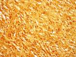 ‘Treponema Pallidum’, La Bacteria Causante De La Sífilis