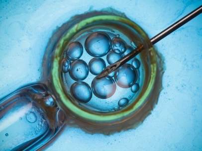 Fecundación in vitro, tratamiento fertilidad