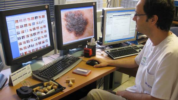 Melanoma Melanoma
