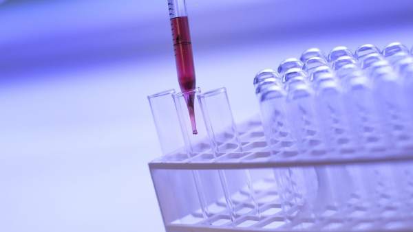 Biopsia