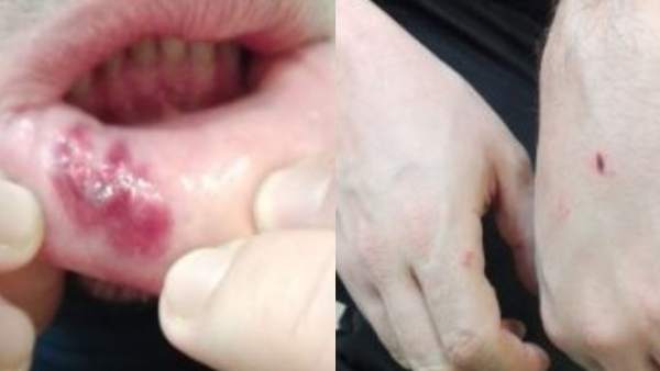 Árbitro agredido Árbitro agredido