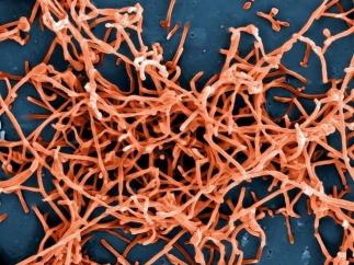Partículas del virus ébola