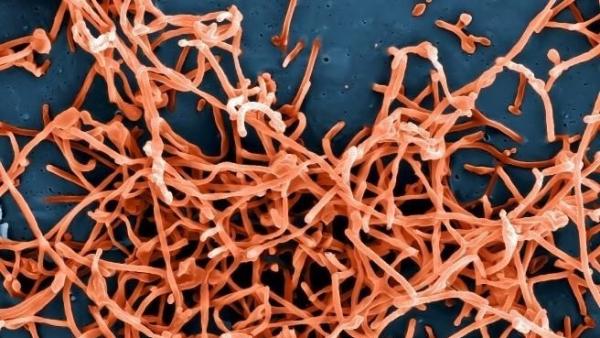 Partículas del virus ébola Partículas del virus ébola