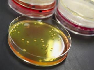 Clostridium botulinum, botulismo