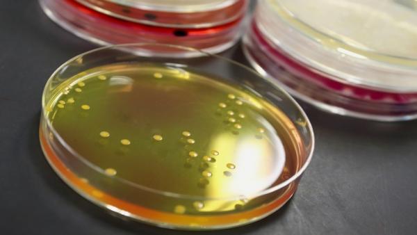 Clostridium botulinum, botulismo Clostridium botulinum, botulismo