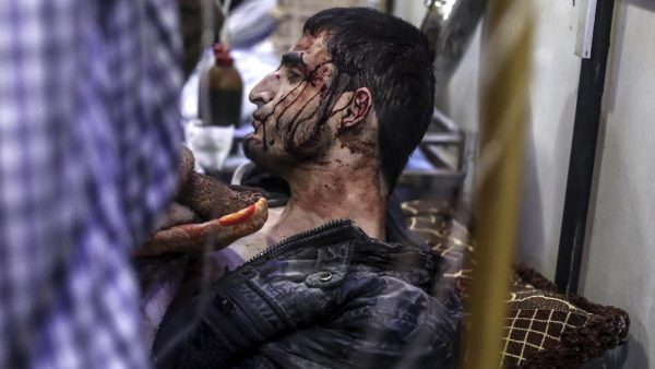 Herido en un bombardeo en Siria Herido en un bombardeo en Siria