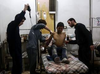 Herido en los bombardeos en Siria