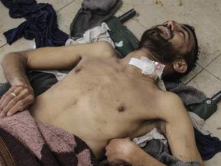 Supuesto ataque químico en Siria