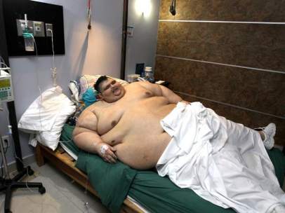 El hombre más obeso del mundo