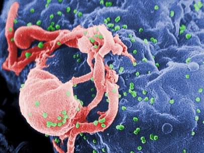 Virus del sida, VIH
