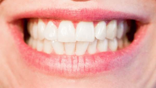 Dientes Dientes