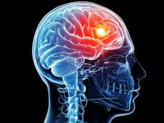 Cerebro