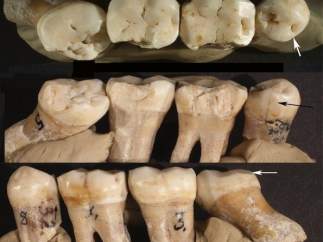 Dientes de neanderthal
