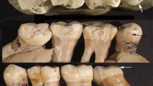 Dientes de neanderthal Dientes de neanderthal
